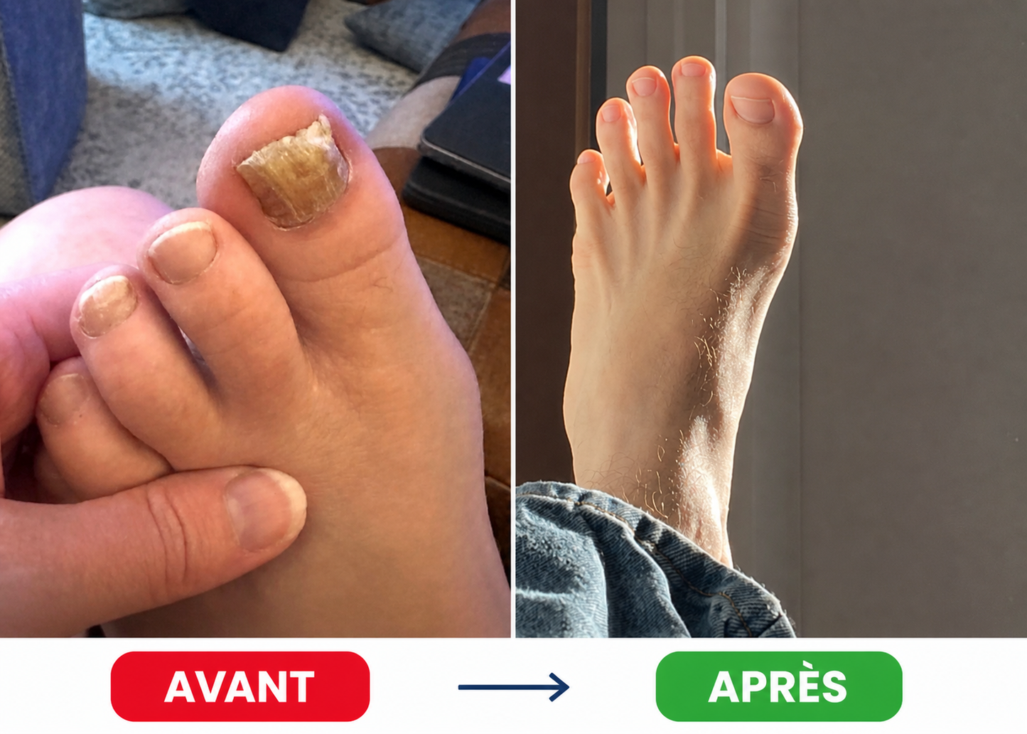 Bellia's - Patchs Réparateurs pour de Plus Beaux Ongles de Pieds