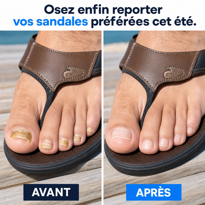 Bellia's - Patchs Réparateurs pour de Plus Beaux Ongles de Pieds